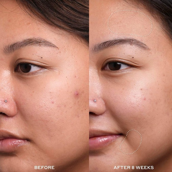 🌿 OLEHENRIKSEN Dewtopia 20% Acid Night Treatment - Picture 4 of 9